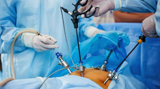 Exploring the Cost of Laparoscopic Surgery in Kerala - What You Should Know