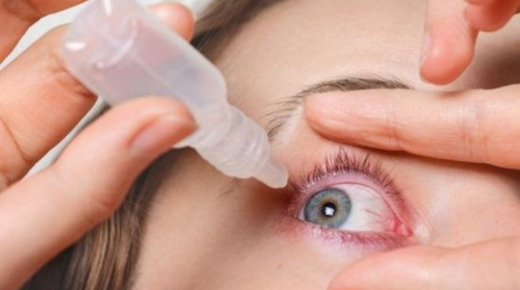 How to Reduce Eye Swelling from Allergies - Effective Home Remedies and Tips