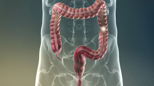 Navigating Your Colorectal Surgery Outpatient Appointment What to Expect