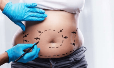 Understanding Full Body Plastic Surgery Costs in India
