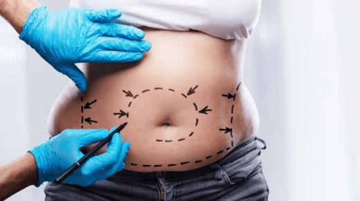 Understanding Full Body Plastic Surgery Costs in India